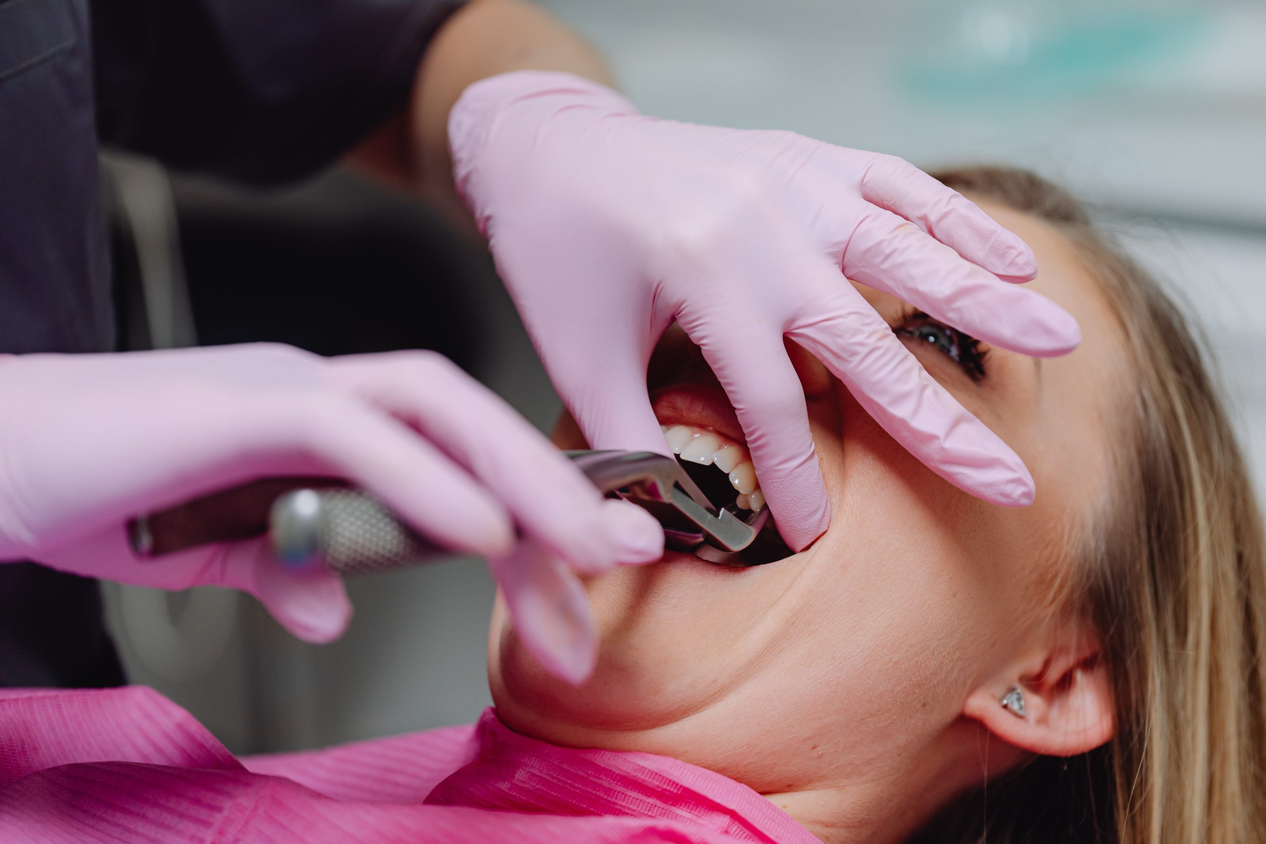 Importance of Root Canal Treatment